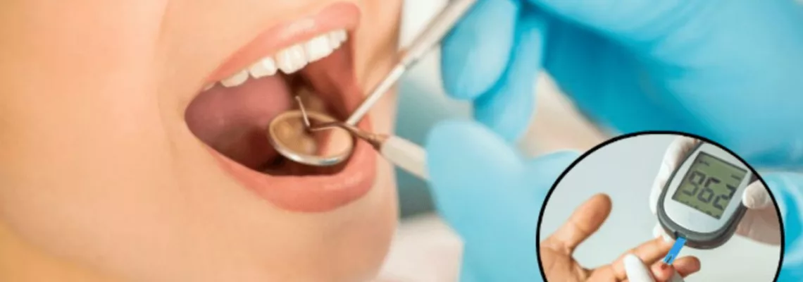 Salud Oral y Diabetes: La Conexión Importante