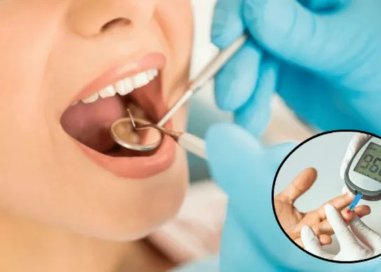 Salud Oral y Diabetes: La Conexión Importante