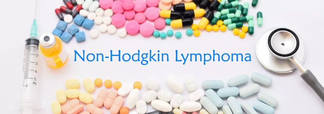 Diagnóstico Temprano del Linfoma no Hodgkin: Claves para la Detección