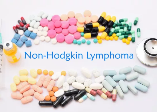 Diagnóstico Temprano del Linfoma no Hodgkin: Claves para la Detección