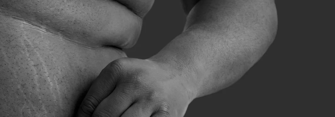 Obesidad y Enfermedades Crónicas: La Relación entre el Exceso de Peso y la Salud