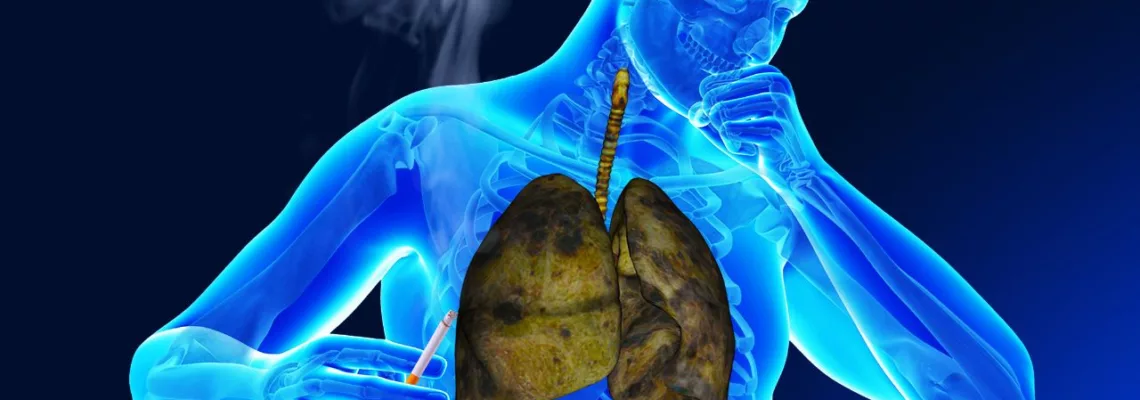 Guía Completa sobre Enfermedades Respiratorias en Fumadores