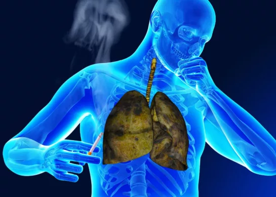 Guía Completa sobre Enfermedades Respiratorias en Fumadores