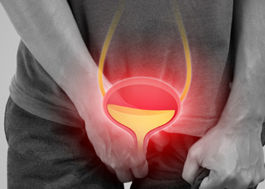 Agrandamiento de la Próstata: ¿Cuándo Debes Preocuparte?