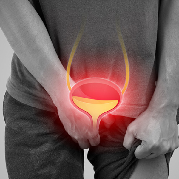 Agrandamiento de la Próstata: ¿Cuándo Debes Preocuparte?